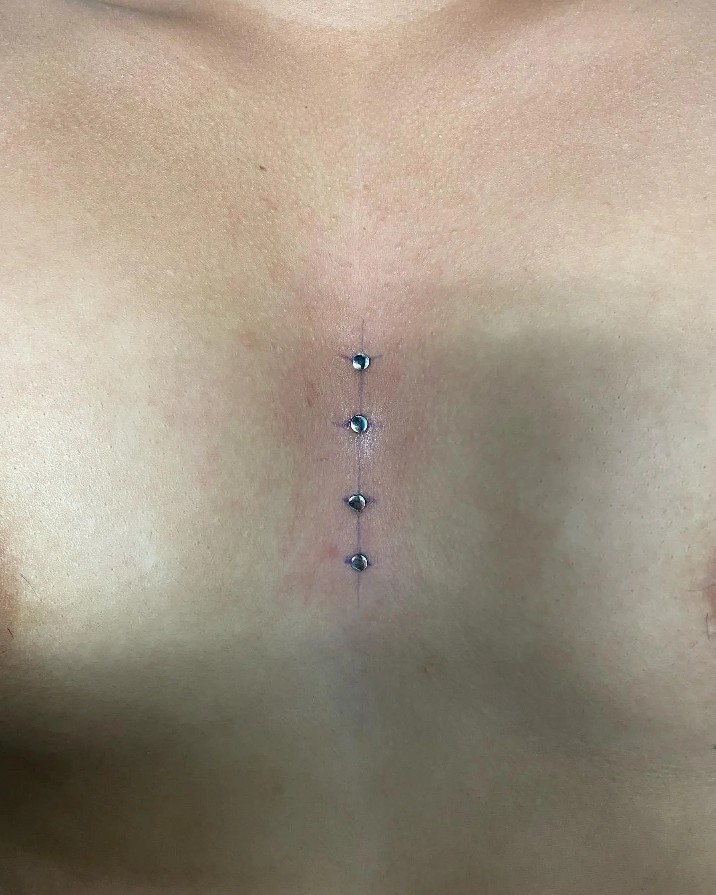 Double Chest Surface — surface piercing